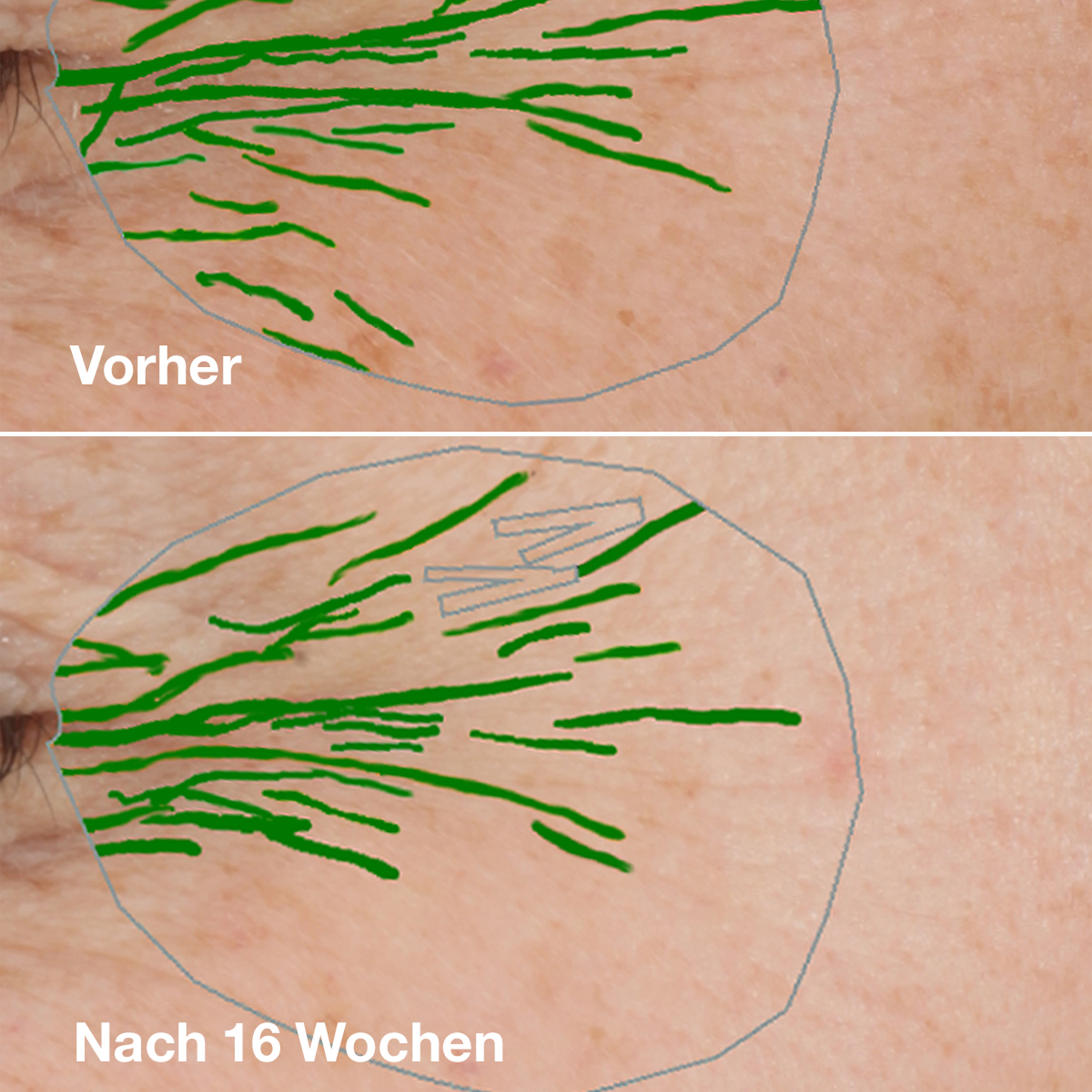 Clinique Smart Clinical Repair Wrinkle Correcting Cream Light