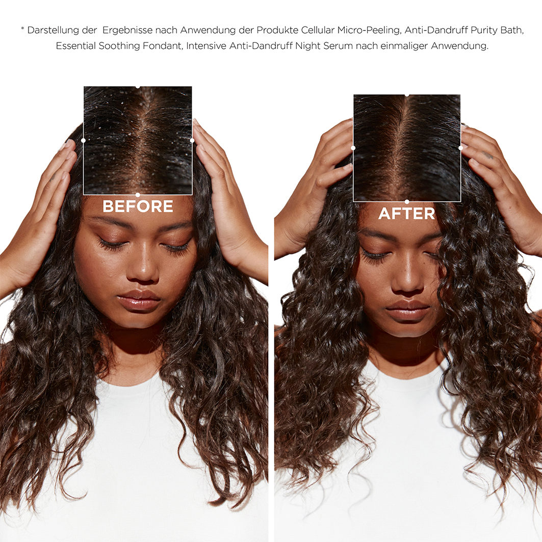 Kérastase Symbiose Crème Anti-Pelliculaire Shampoo