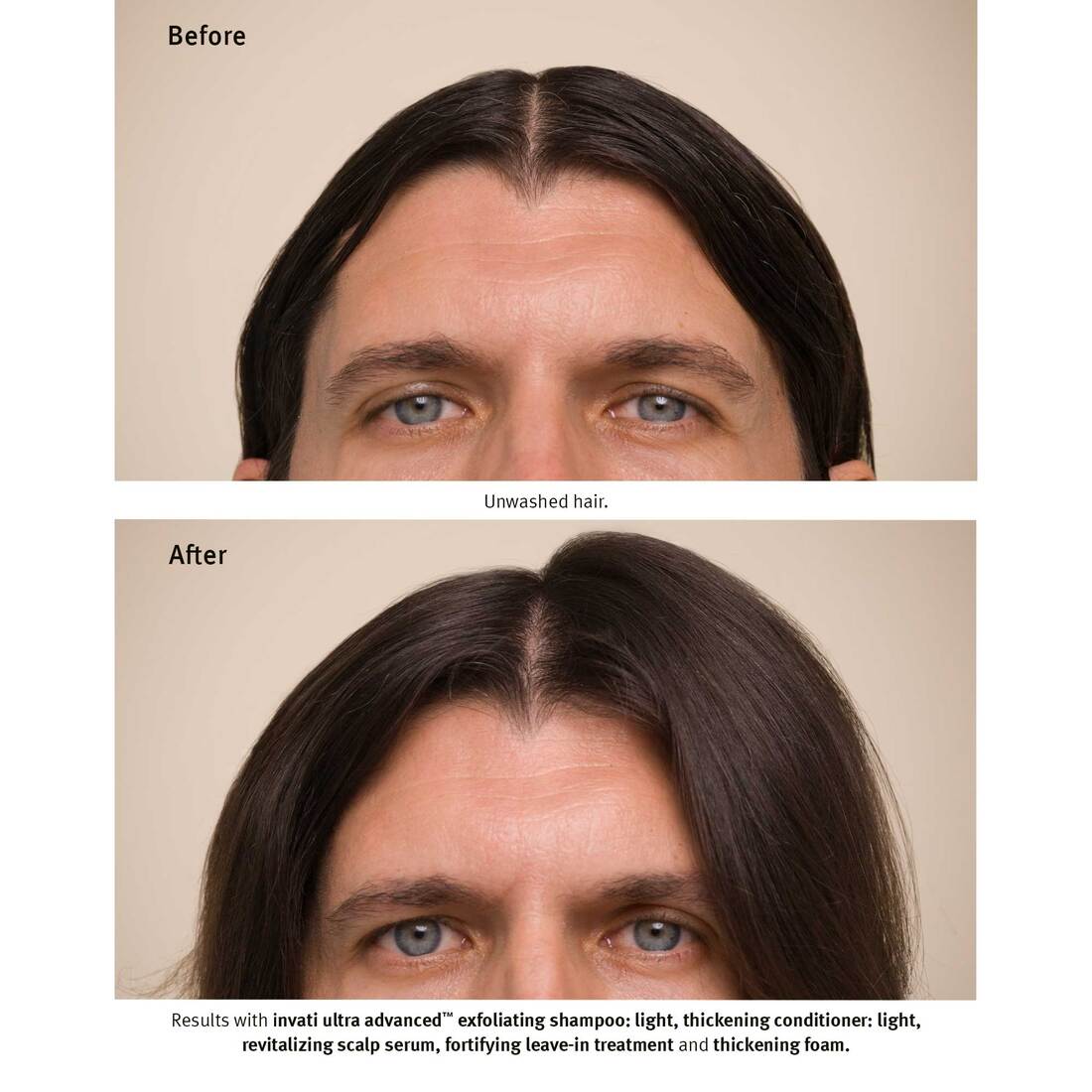 Aveda Invati Ultra Advanced Revitalizing Scalp Serum