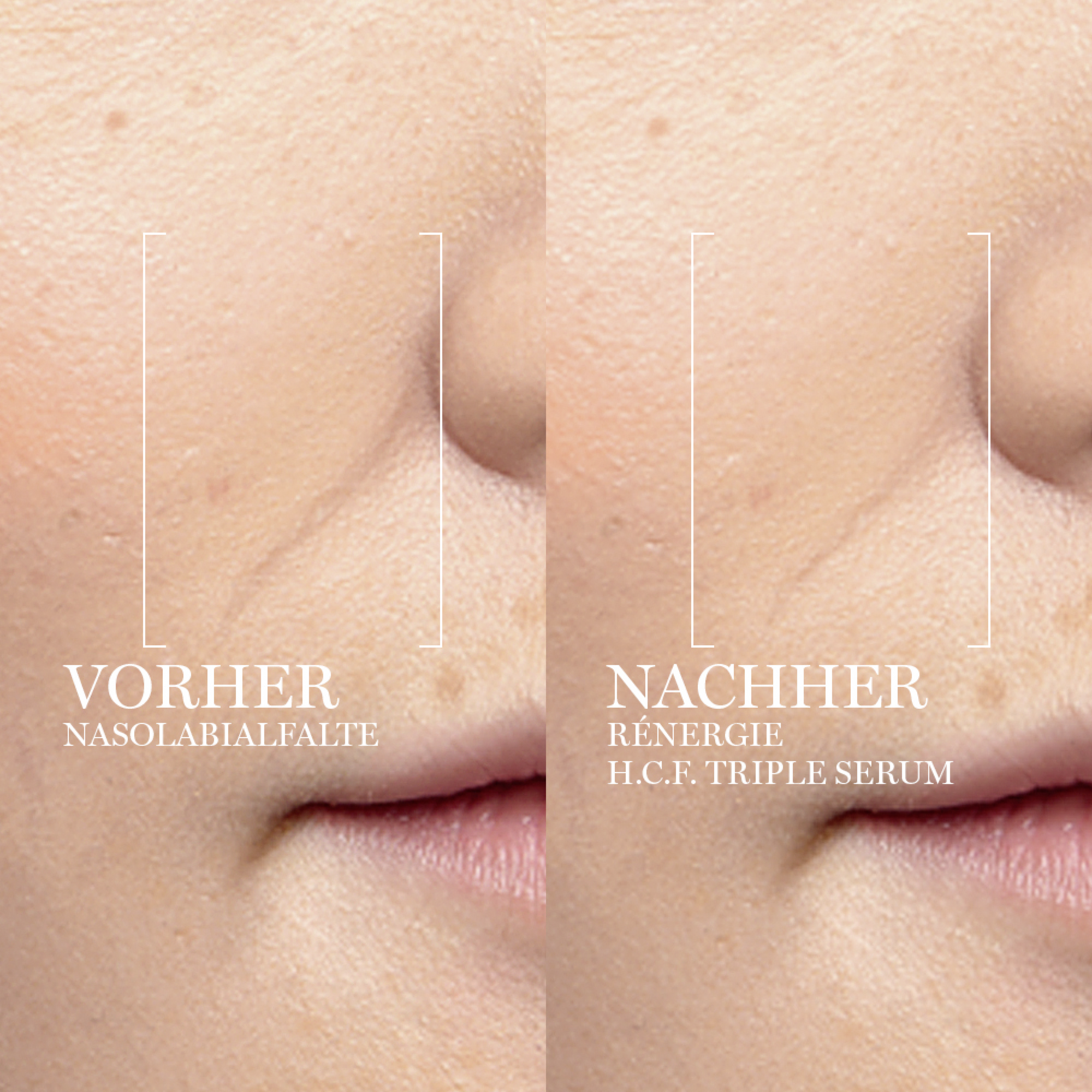 Lancôme Rénergie Multi-Lift Triple Serum